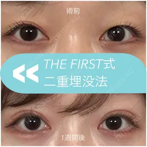 THE FIRST CLINIC 多摩センター院 惟村 公郁医師の症例