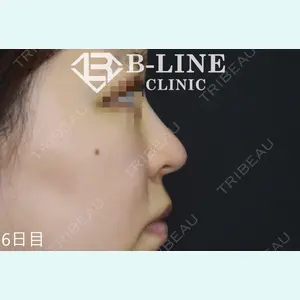 B-LINE CLINIC 池袋院 小池 康弘医師の症例