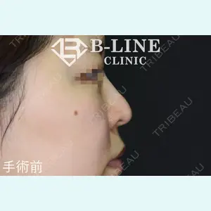 B-LINE CLINIC 池袋院 小池 康弘医師の症例