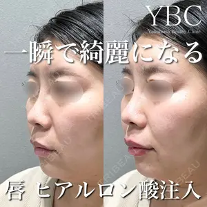 YBC横浜美容外科 大宮院 山本　有祐医師の症例