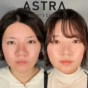ASTRA BEAUTY CLINIC 塩満 惠子医師の症例