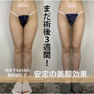GAYA body design clinic 飯ヶ谷 重来医師の症例