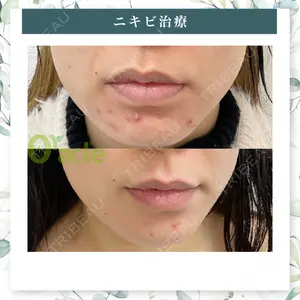 オラクル美容皮膚科 名古屋院の症例