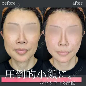 ルラ美容クリニック 名古屋本院 馬場 愛理医師の症例