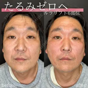 ルラ美容クリニック 名古屋本院 馬場 愛理医師の症例