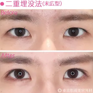 東京形成美容外科 銀座院 恩田　慶子医師の症例