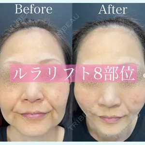 ルラ美容クリニック 渋谷本院 昼間 路子医師の症例