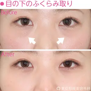 東京形成美容外科 銀座院 恩田　慶子医師の症例