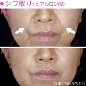 東京形成美容外科 銀座院 恩田　慶子医師の症例