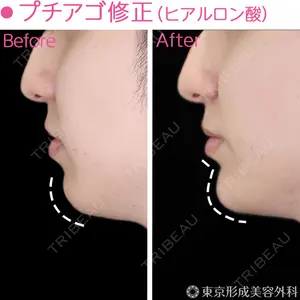 東京形成美容外科 銀座院 恩田　慶子医師の症例