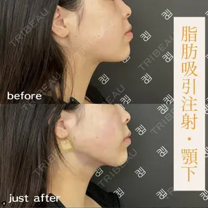 EMMO FACE CLINIC 大阪梅田院 山﨑 冴羅医師の症例