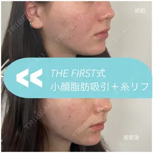 THE FIRST CLINIC 多摩センター院 惟村 公郁医師の症例