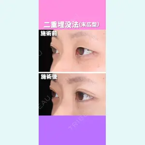 東京形成美容外科 銀座院 恩田　慶子医師の症例