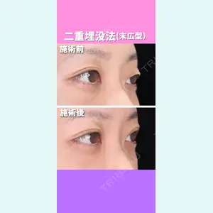 東京形成美容外科 銀座院 恩田　慶子医師の症例