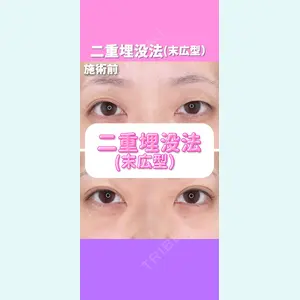 東京形成美容外科 銀座院 恩田　慶子医師の症例