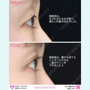 東京形成美容外科 船橋院 弓削田　浩主医師の症例