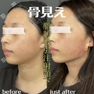 EMMO FACE CLINIC 大阪梅田院 山﨑 冴羅医師の症例