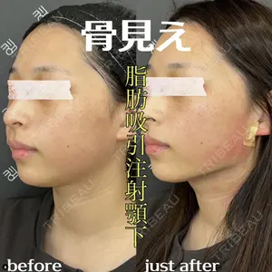 EMMO FACE CLINIC 大阪梅田院 山﨑 冴羅医師の症例