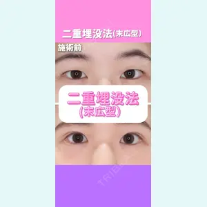 東京形成美容外科 銀座院 恩田　慶子医師の症例