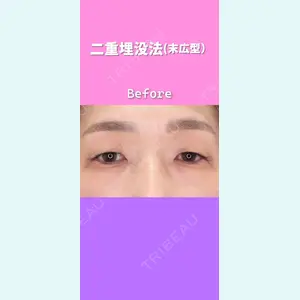 東京形成美容外科 銀座院 恩田　慶子医師の症例