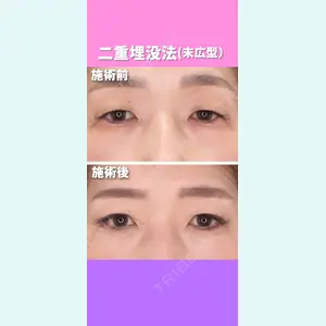 東京形成美容外科 銀座院 恩田　慶子医師の症例