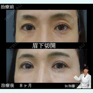 ルーチェクリニック 銀座院 加藤晴之輔医師の症例