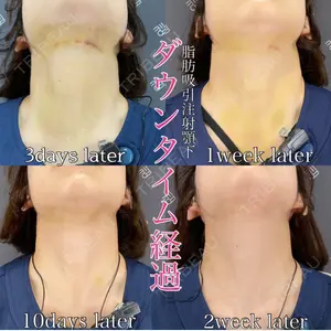 EMMO FACE CLINIC 大阪梅田院 山﨑 冴羅医師の症例