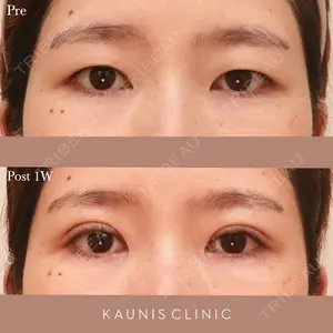 KAUNIS CLINIC（カウニスクリニック） 高野 敏郎医師の症例