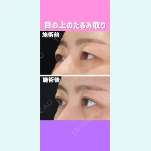 東京形成美容外科 銀座院 恩田　慶子医師の症例