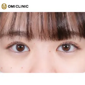 OMI CLINIC 【オミクリニック】 木下 竜臣医師の症例