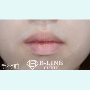 B-LINE CLINIC 池袋院 小池 康弘医師の症例