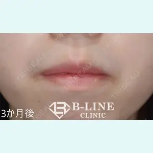 B-LINE CLINIC 池袋院 小池 康弘医師の症例