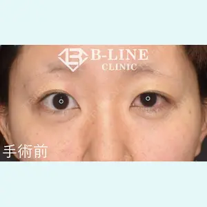 B-LINE CLINIC 池袋院 小池 康弘医師の症例