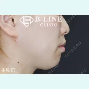 B-LINE CLINIC 池袋院 小池 康弘医師の症例