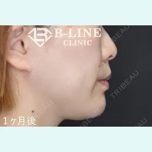 B-LINE CLINIC 池袋院 小池 康弘医師の症例