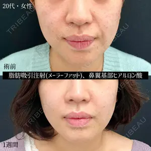 東京シンデレラ美容外科 大宮院 髙田 怜医師の症例