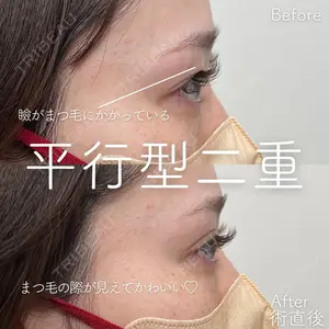 SK新宿歌舞伎町美容外科・歯科の症例