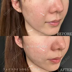 ルラ美容クリニック 新潟院の症例