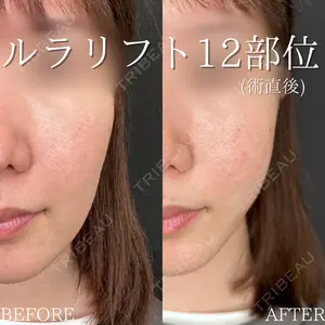 ルラ美容クリニック 高田馬場院 若佐 卓矢医師の症例