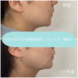 THE FIRST CLINIC 多摩センター院 惟村 公郁医師の症例