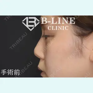 B-LINE CLINIC 池袋院 小池 康弘医師の症例