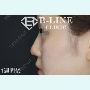 B-LINE CLINIC 池袋院 小池 康弘医師の症例