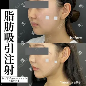 EMMO FACE CLINIC 大阪梅田院 山﨑 冴羅医師の症例