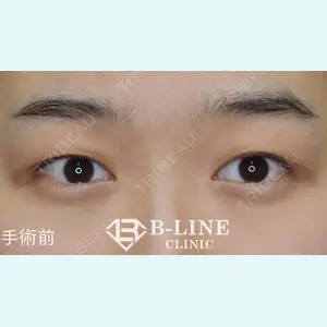 B-LINE CLINIC 池袋院 小池 康弘医師の症例