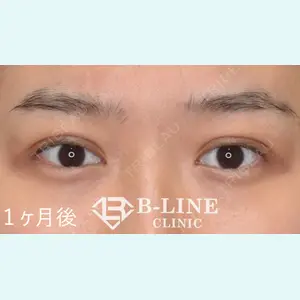 B-LINE CLINIC 池袋院 小池 康弘医師の症例