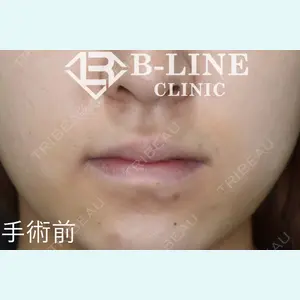 B-LINE CLINIC 池袋院 小池 康弘医師の症例