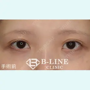 B-LINE CLINIC 池袋院 小池 康弘医師の症例