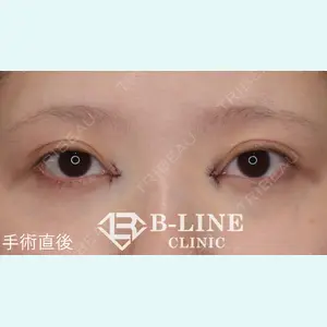 B-LINE CLINIC 池袋院 小池 康弘医師の症例