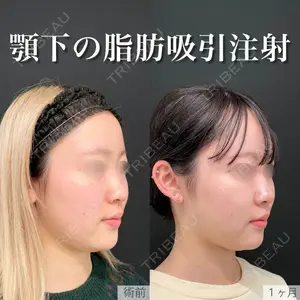 東京シンデレラ美容外科 新宿院の症例