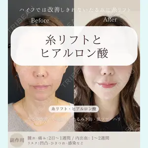 自由が丘ウェルエイジングビューティークリニックの症例
